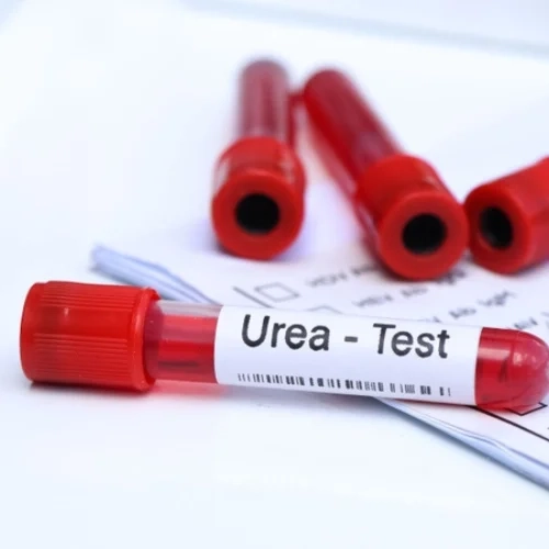 Định lượng Ure máu