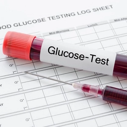 Định lượng Glucose máu