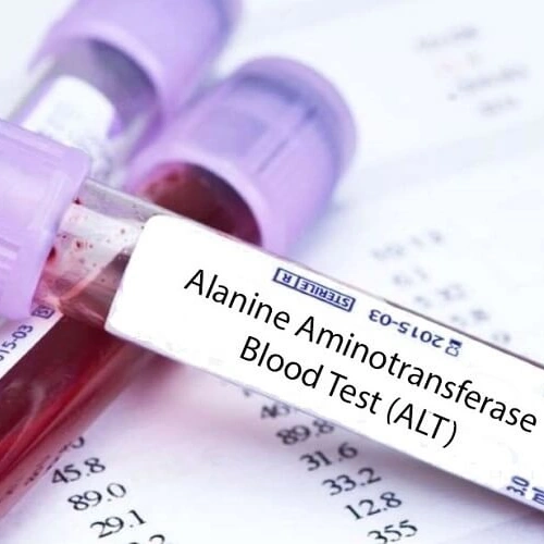 Xét nghiệm máu đo hoạt độ ALT (GPT), AST (GOT)