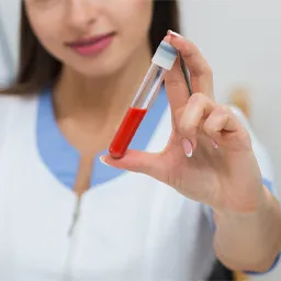 Xét nghiệm máu tổng quát