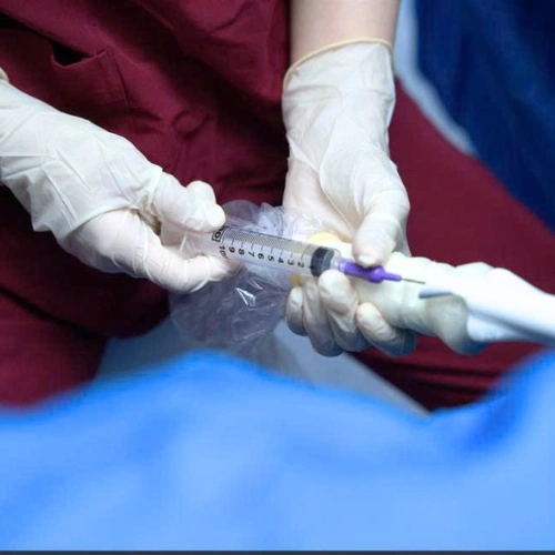 Bước 1: Kích thích buồng trứng