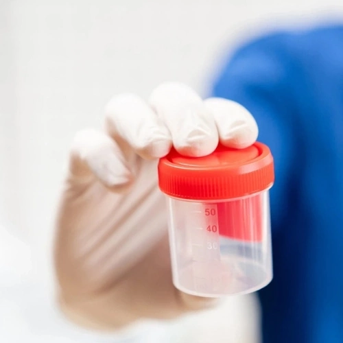 Bước 2: Chọc hút trứng và lấy mẫu tinh trùng