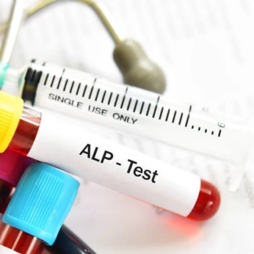 Đo hoạt độ ALP (Alkaline Phosphatase):