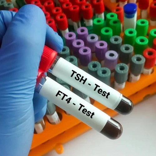 Định lượng FT4 & TSH: