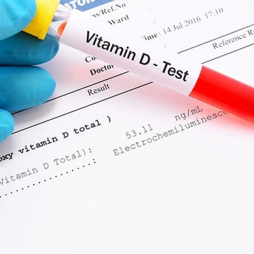 Định lượng 25OH Vitamin D (D3):