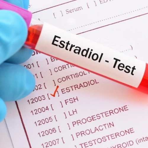 Định lượng Estradiol: