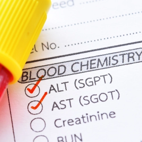 Đo hoạt độ AST (GOT) và ALT (GPT):