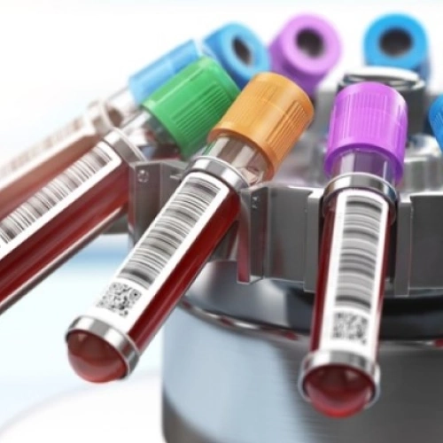 Định lượng Kẽm: