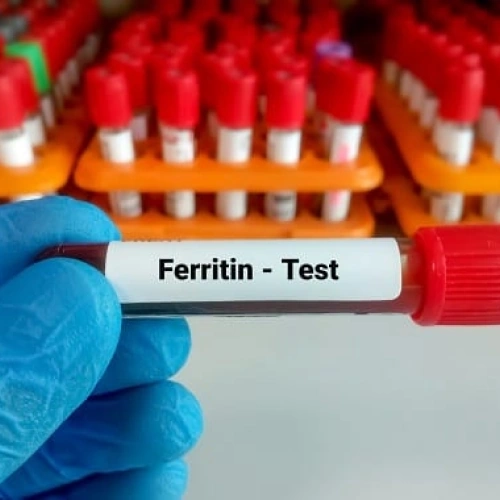 Định lượng Ferritin: