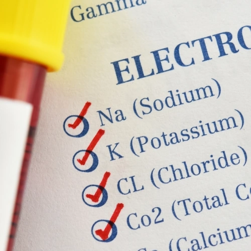 Điện giải đồ (Na, K, Cl):