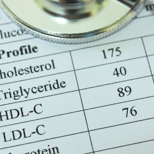 Bộ xét nghiệm mỡ máu (Cholesterol toàn phần, Triglycerid, HDL-C, LDL-C):