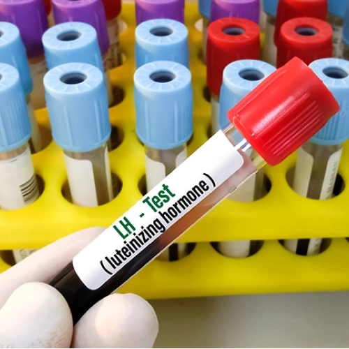 Định lượng LH (Luteinizing Hormone):