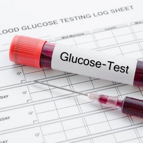 Định lượng Glucose: