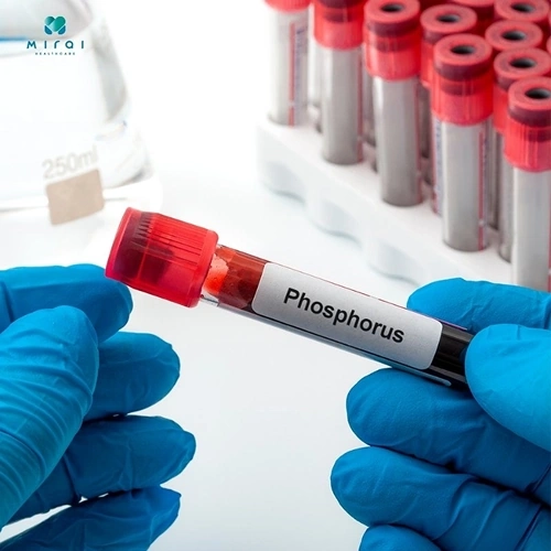 Định lượng Phospho: