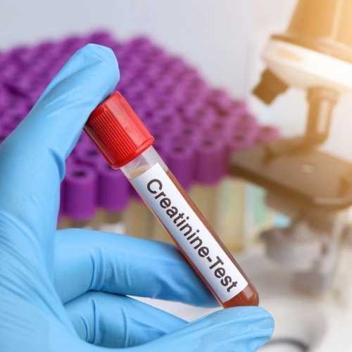 Định lượng Creatinin