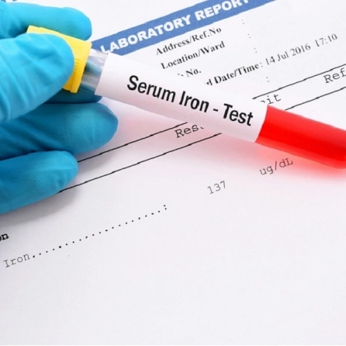 Định lượng Sắt