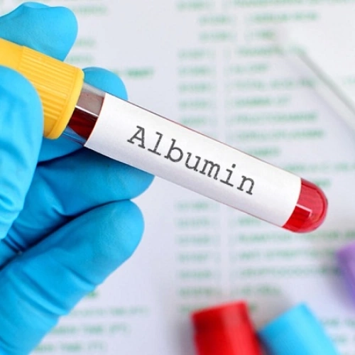 Định lượng Albumin