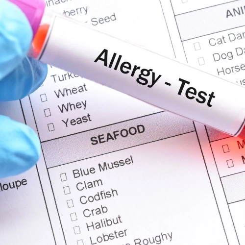 Allergy Panel 1 VIET: