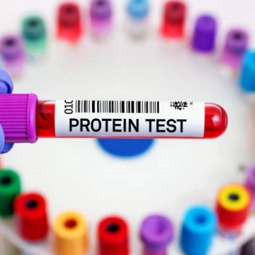 Định lượng Protein toàn phần