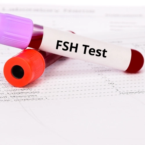 Định lượng FSH (Follicle Stimulating Hormone):