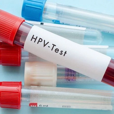 Xét nghiệm HPV genotype Real-time PCR (28 type)