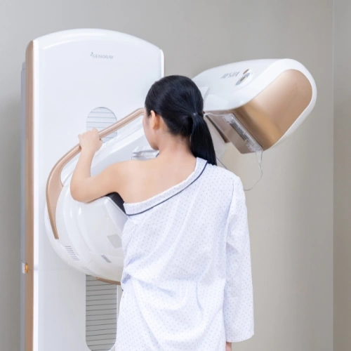 Chụp X-quang tuyến vú (Mammography)