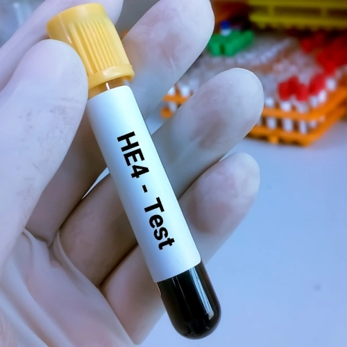 Xét nghiệm định lượng HE4