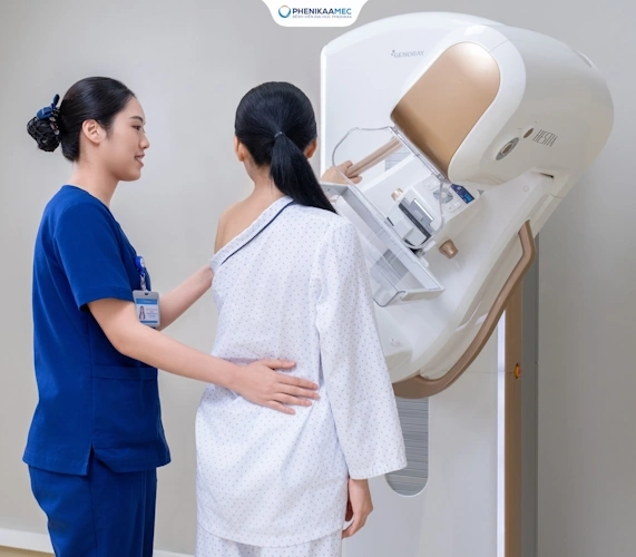 Chụp X-quang tuyến vú (Mammography)