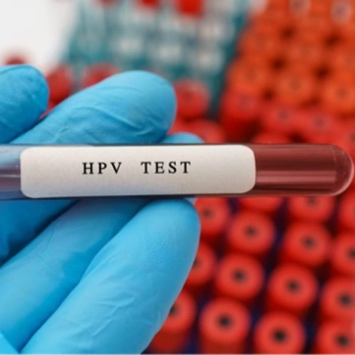 HPV Genotype Real-time PCR (định danh 28 type HPV)