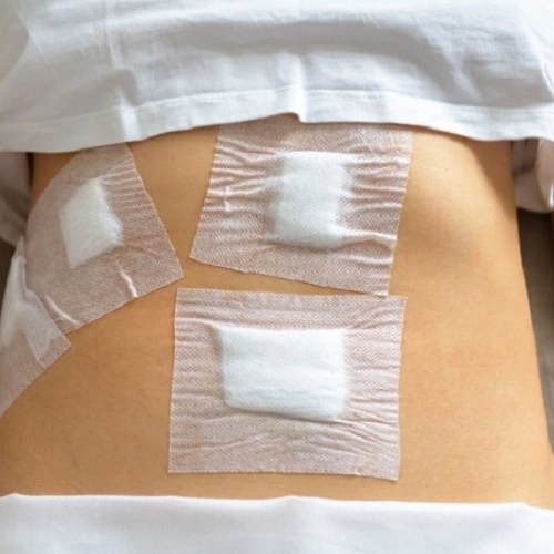 Chăm sóc hậu phẫu toàn diện