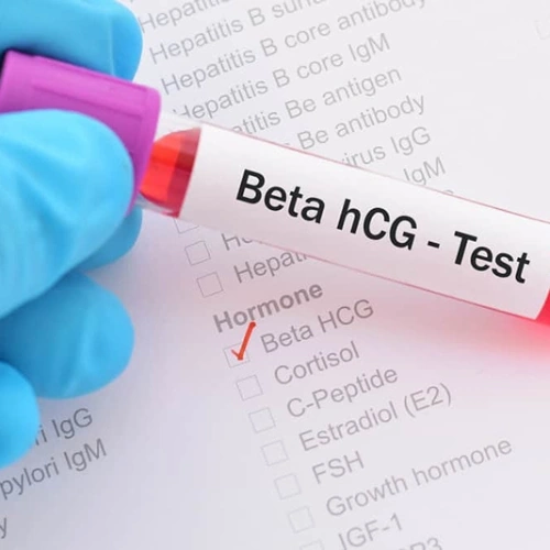 Xét nghiệm định lượng Beta hCG (Beta human Chorionic Gonadotropin) sau phẫu thuật