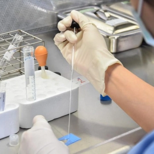 Lọc rửa tinh trùng: