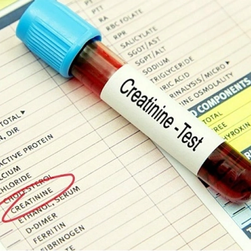 Định lượng Creatinin, Ure máu