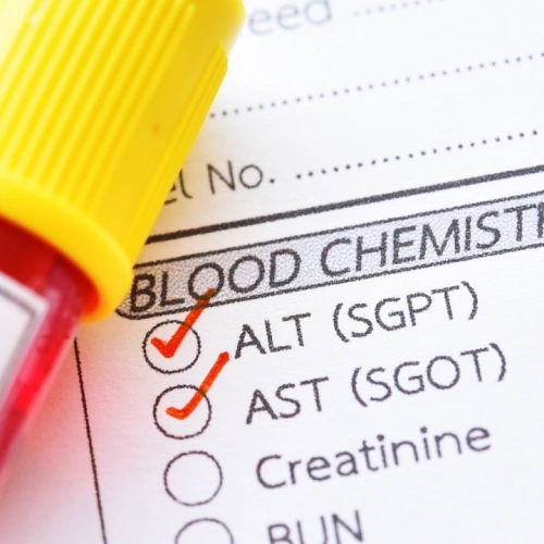 Đo hoạt độ ALT (GPT), AST (GOT), GGT (Gamma Glutamyl Transferase)