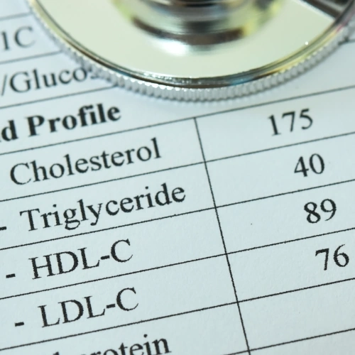 Định lượng Cholesterol toàn phần, Triglycerid, HDL-C, LDL-C