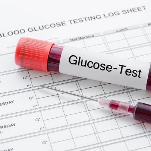Định lượng Glucose