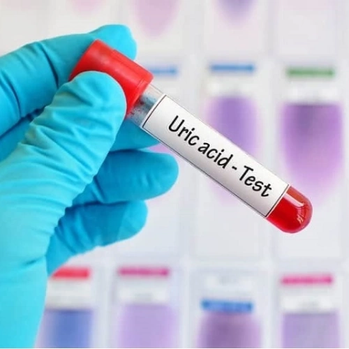 Định lượng Acid Uric