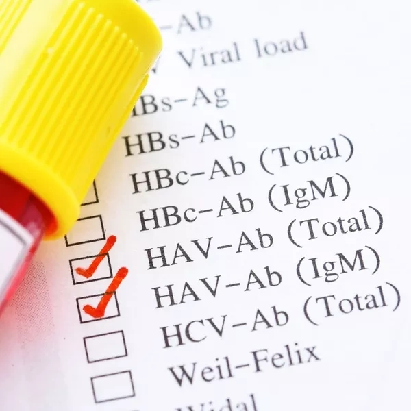 HAV IgM và HAV total miễn dịch tự động