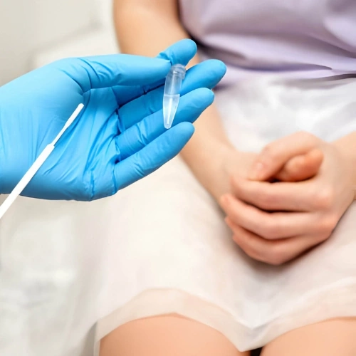 Xét nghiệm dịch âm đạo
