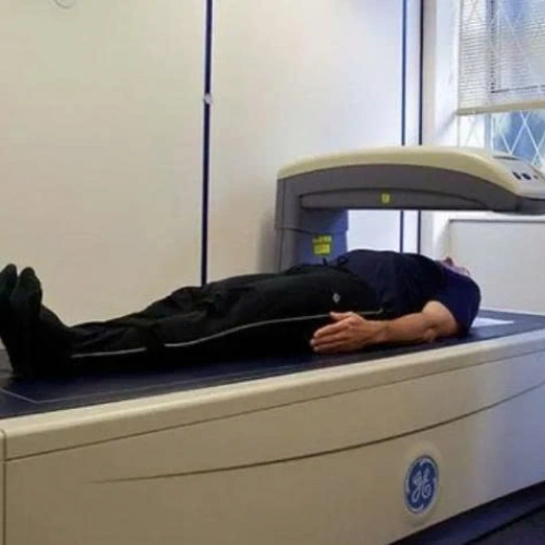 Đo mật độ xương DEXA