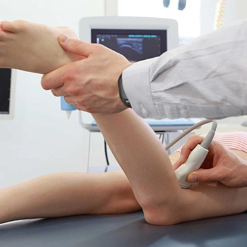 Siêu âm Doppler động mạch và tĩnh mạch chi dưới