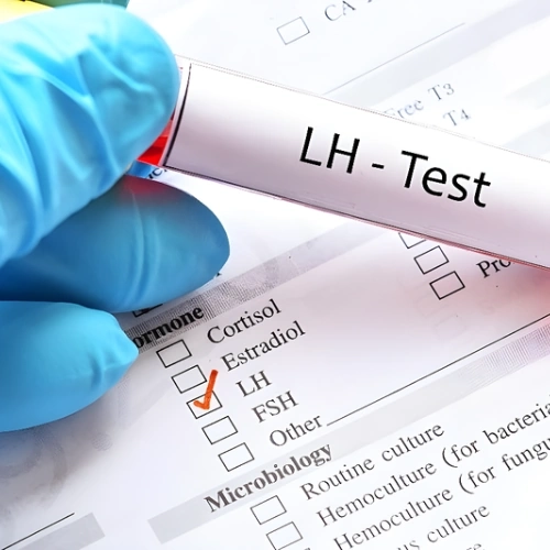 Xét nghiệm LH (Luteinizing Hormone)