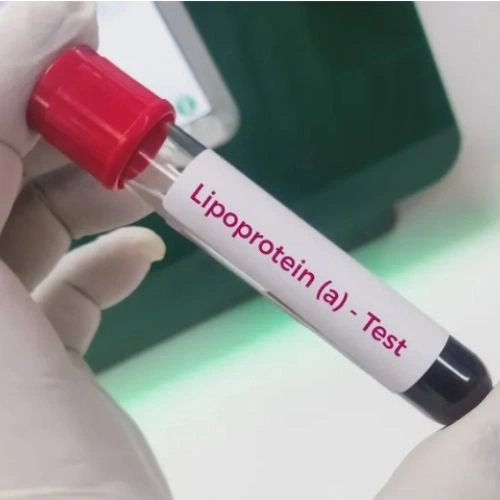 Xét nghiệm Lipoprotein (a)
