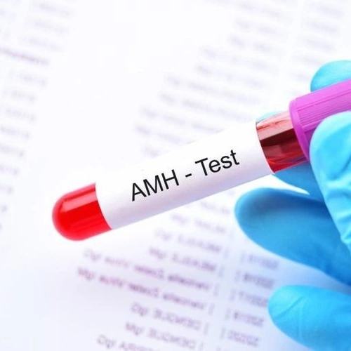 Định lượng AMH (Anti-Mullerian Hormone)