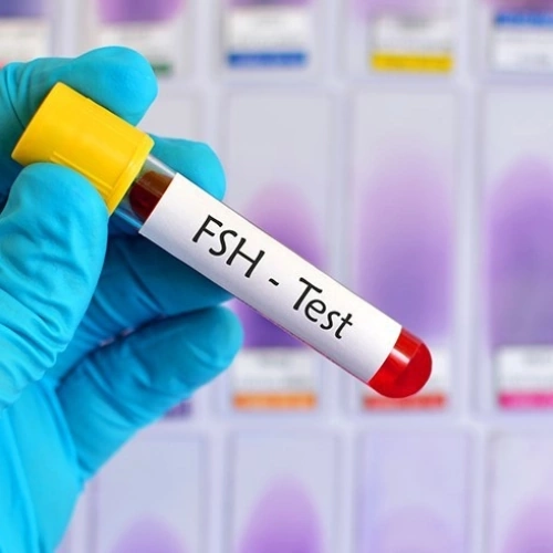 Xét nghiệm FSH (Follicle Stimulating Hormone)