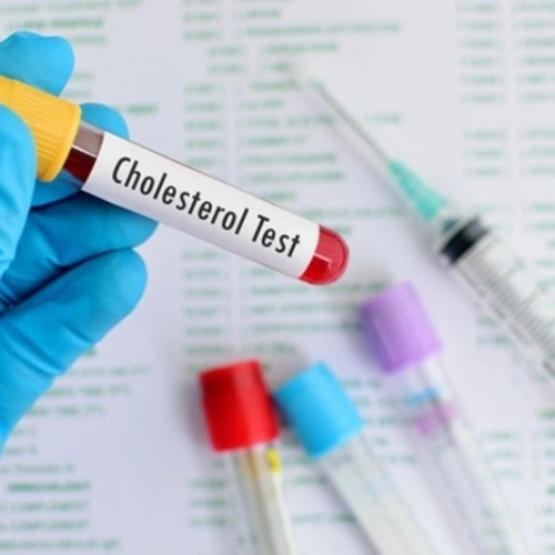 Bộ xét nghiệm mỡ máu (Cholesterol toàn phần, Triglycerid, HDL-C, LDL-C)