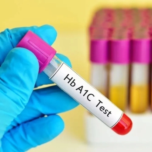 Định lượng HbA1c