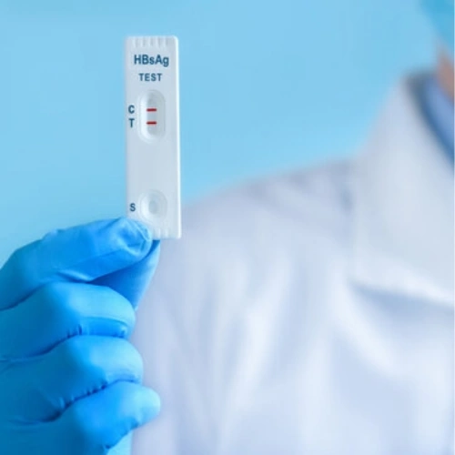 HBsAg test nhanh
