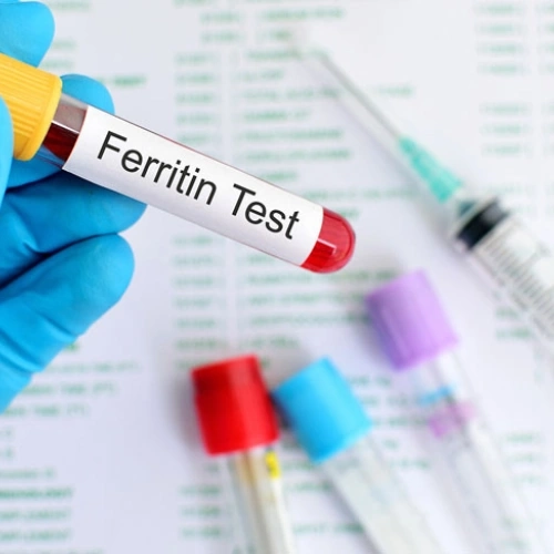 Ferritin và Sắt huyết thanh