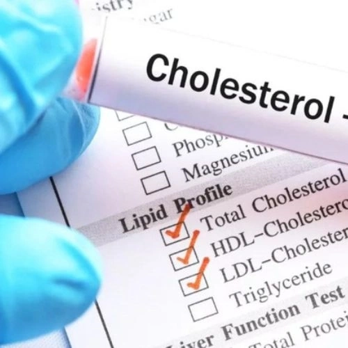 Bộ xét nghiệm mỡ máu (Cholesterol toàn phần, Triglycerid, HDL-C, LDL-C)